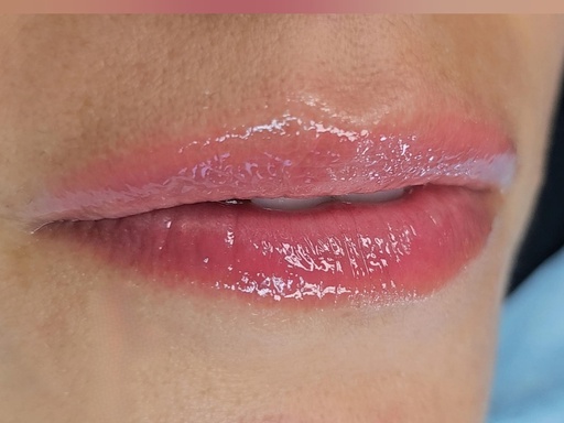 TRATAMIENTO HYDRA GLOSS LIPS 