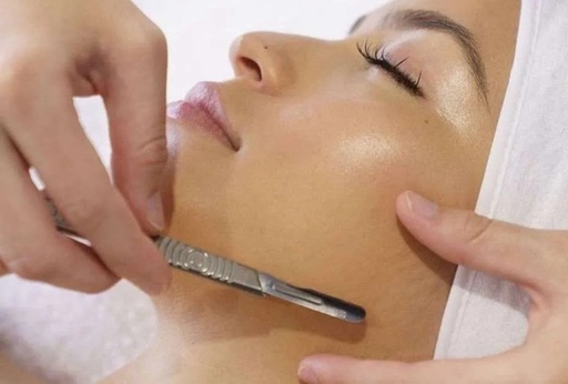 PROCEDIMIENTO DERMAPLANING
