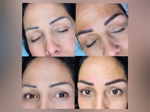 MICROPIGMENTACION TECNICA DE COVER UP (COBERTURA DE PROCEDIMIENTO ANTIGUO O TATUAJE)