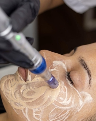 LIMPIEZA FACIAL PROFUNDA+ DERMAPLANING+BBGLOW